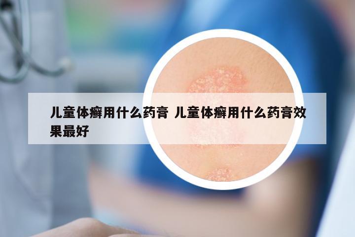 儿童体癣用什么药膏 儿童体癣用什么药膏效果最好
