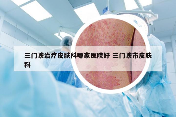 三门峡治疗皮肤科哪家医院好 三门峡市皮肤科