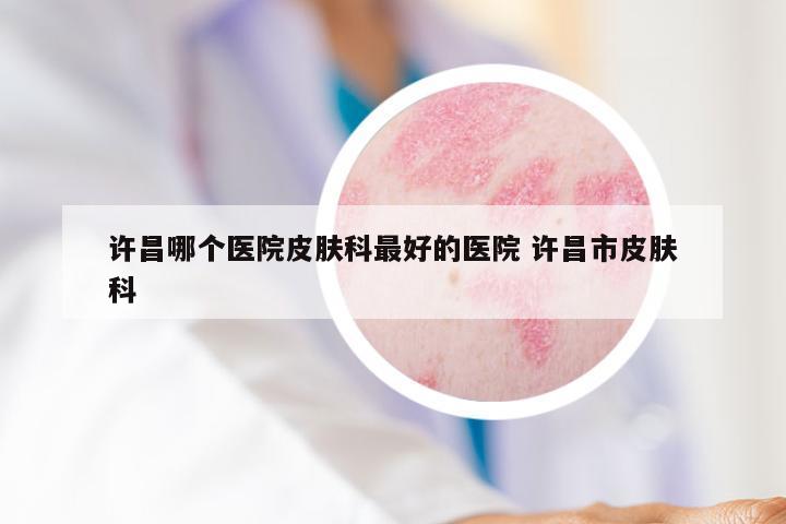 许昌哪个医院皮肤科最好的医院 许昌市皮肤科