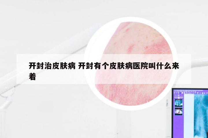 开封治皮肤病 开封有个皮肤病医院叫什么来着