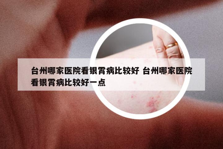 台州哪家医院看银霄病比较好 台州哪家医院看银霄病比较好一点