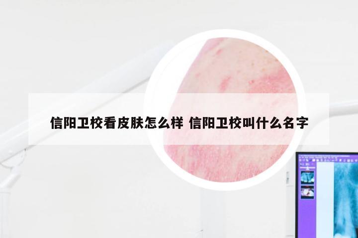 信阳卫校看皮肤怎么样 信阳卫校叫什么名字