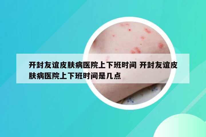 开封友谊皮肤病医院上下班时间 开封友谊皮肤病医院上下班时间是几点