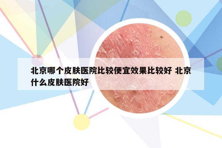 北京哪个皮肤医院比较便宜效果比较好 北京什么皮肤医院好