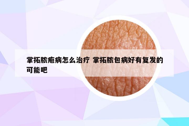 掌拓脓疱病怎么治疗 掌拓脓包病好有复发的可能吧