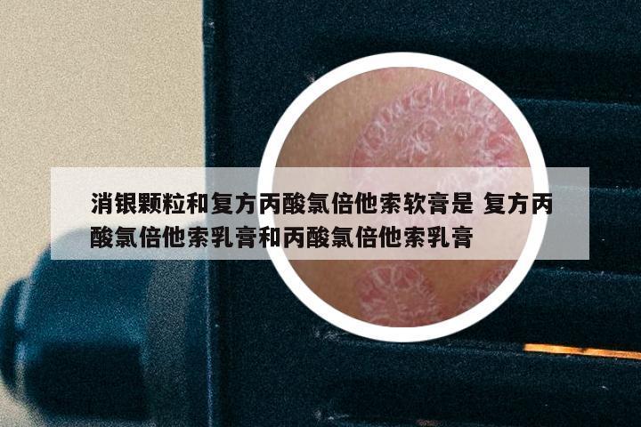 消银颗粒和复方丙酸氯倍他索软膏是 复方丙酸氯倍他索乳膏和丙酸氯倍他索乳膏