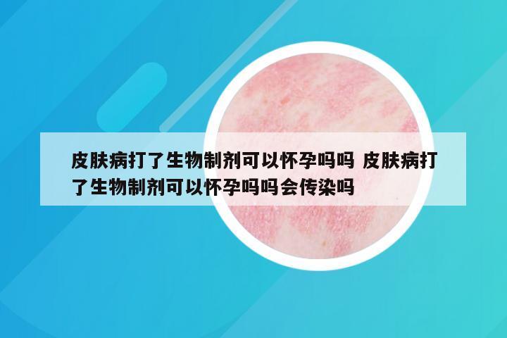 皮肤病打了生物制剂可以怀孕吗吗 皮肤病打了生物制剂可以怀孕吗吗会传染吗