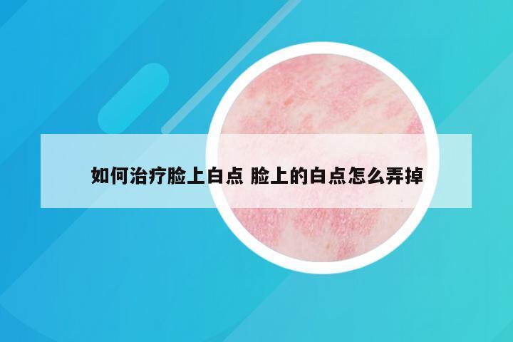 如何治疗脸上白点 脸上的白点怎么弄掉