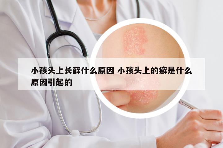 小孩头上长藓什么原因 小孩头上的癣是什么原因引起的