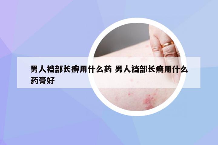 男人裆部长癣用什么药 男人裆部长癣用什么药膏好