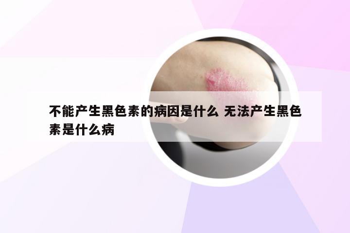 不能产生黑色素的病因是什么 无法产生黑色素是什么病