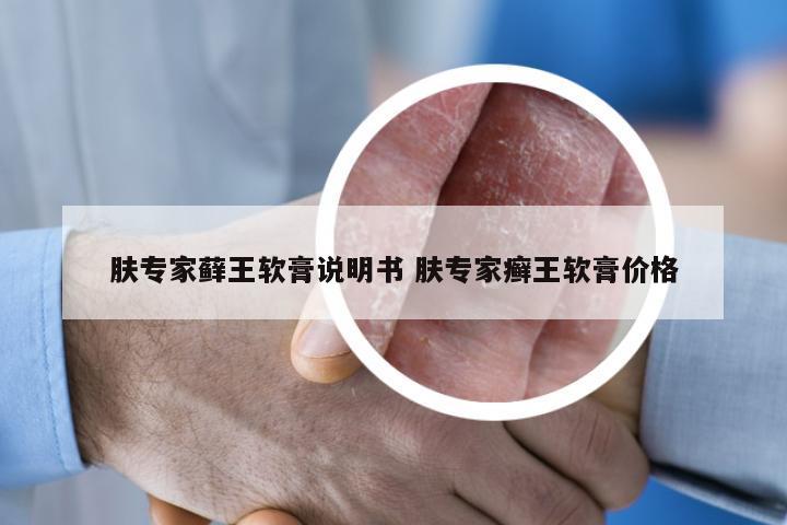 肤专家藓王软膏说明书 肤专家癣王软膏价格
