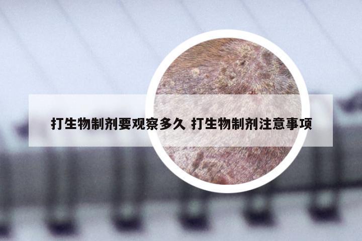 打生物制剂要观察多久 打生物制剂注意事项