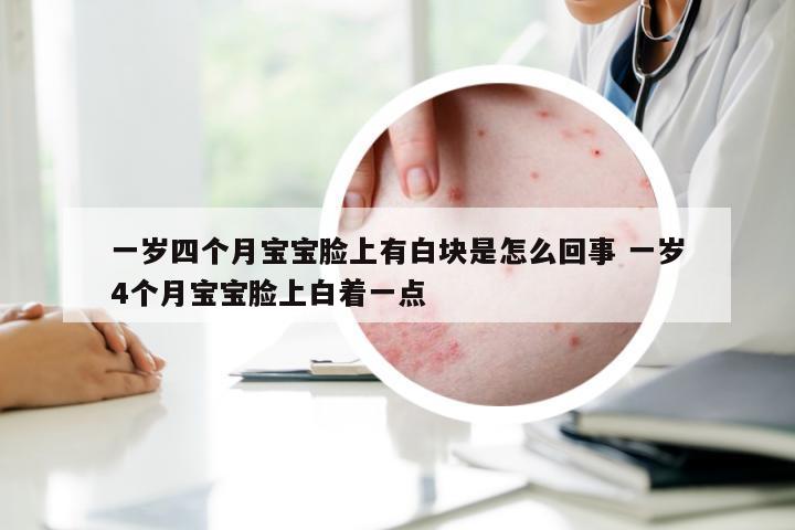 一岁四个月宝宝脸上有白块是怎么回事 一岁4个月宝宝脸上白着一点