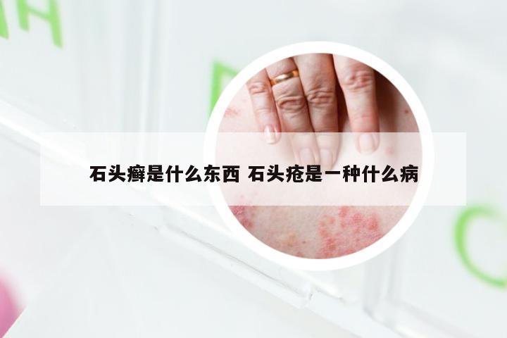 石头癣是什么东西 石头疮是一种什么病