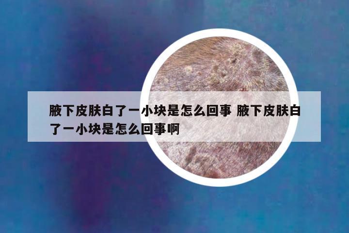 腋下皮肤白了一小块是怎么回事 腋下皮肤白了一小块是怎么回事啊