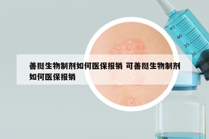 善挺生物制剂如何医保报销 可善挺生物制剂如何医保报销
