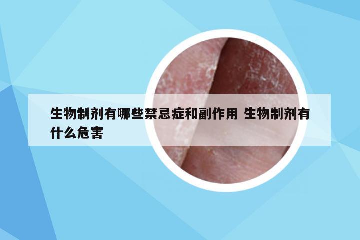 生物制剂有哪些禁忌症和副作用 生物制剂有什么危害