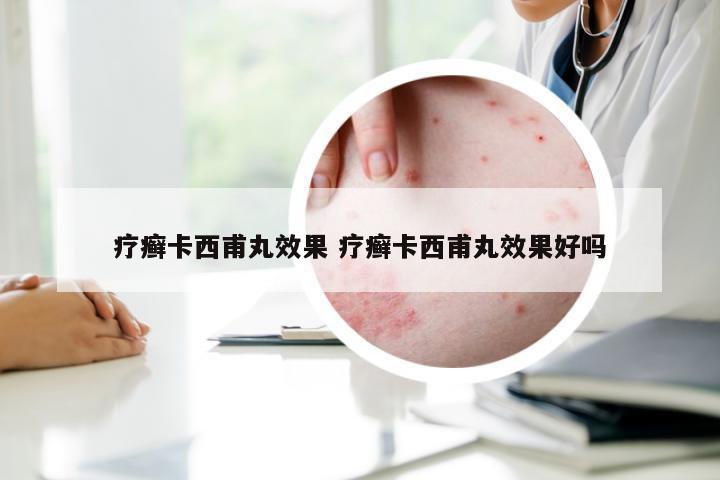 疗癣卡西甫丸效果 疗癣卡西甫丸效果好吗
