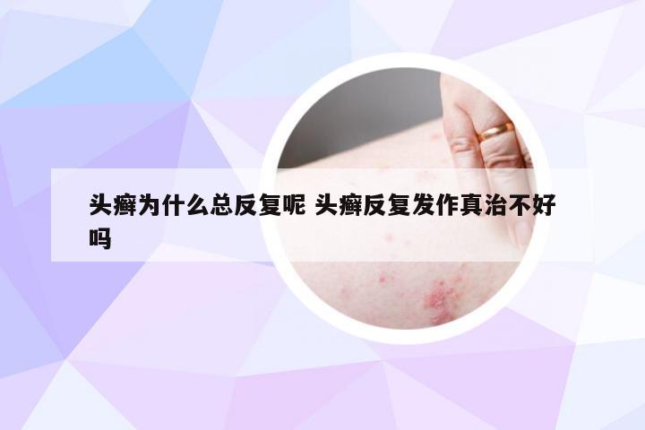 头癣为什么总反复呢 头癣反复发作真治不好吗