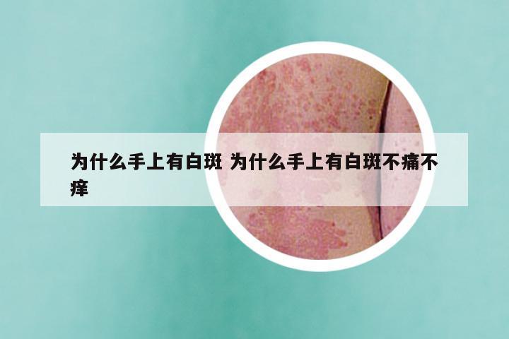 为什么手上有白斑 为什么手上有白斑不痛不痒