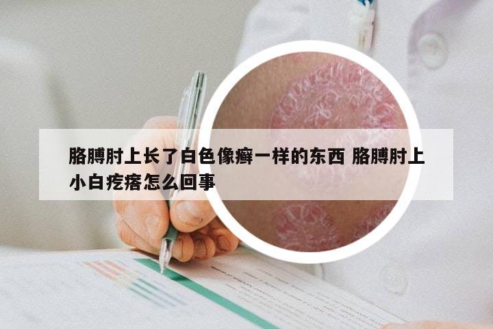 胳膊肘上长了白色像癣一样的东西 胳膊肘上小白疙瘩怎么回事