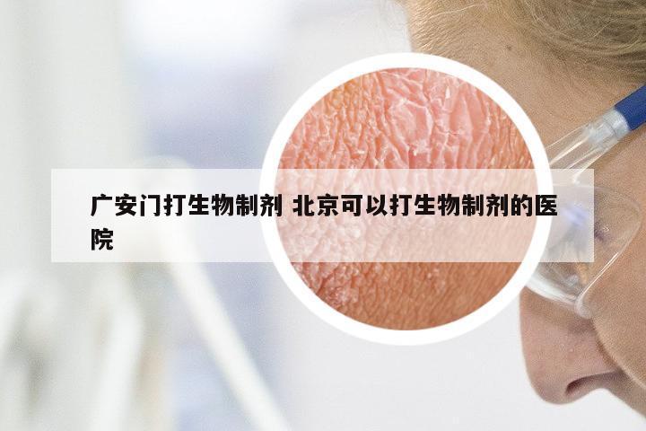 广安门打生物制剂 北京可以打生物制剂的医院