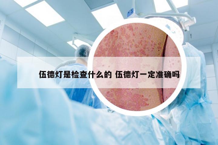 伍德灯是检查什么的 伍德灯一定准确吗