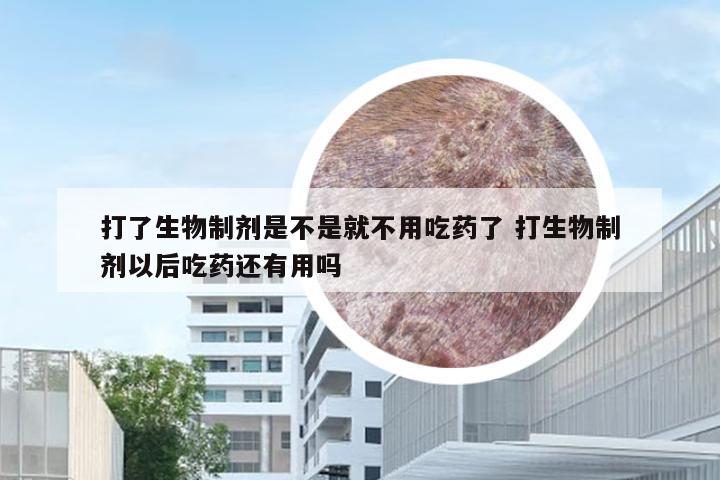 打了生物制剂是不是就不用吃药了 打生物制剂以后吃药还有用吗