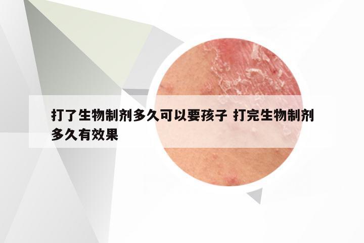 打了生物制剂多久可以要孩子 打完生物制剂多久有效果