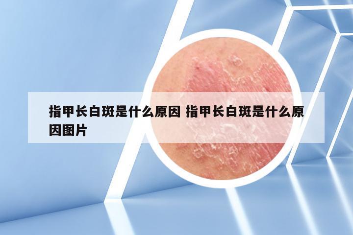 指甲长白斑是什么原因 指甲长白斑是什么原因图片
