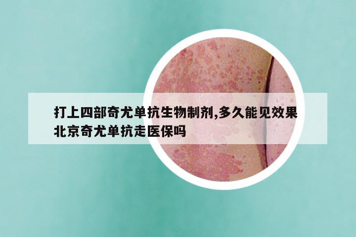 打上四部奇尤单抗生物制剂,多久能见效果 北京奇尤单抗走医保吗