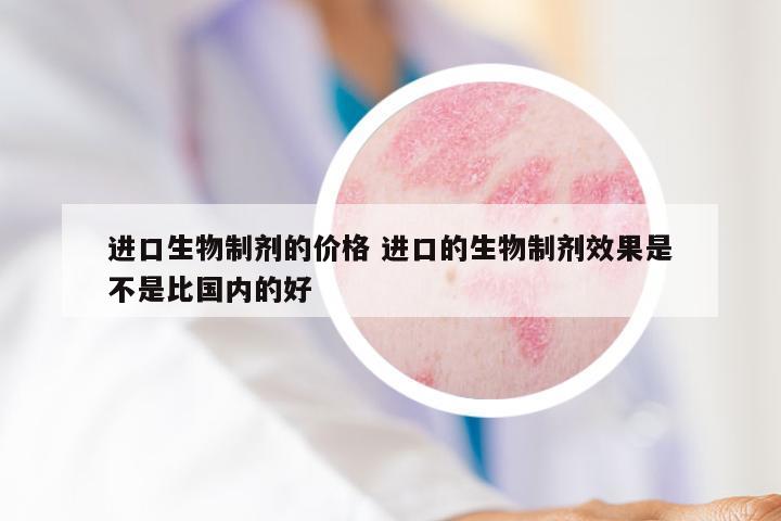 进口生物制剂的价格 进口的生物制剂效果是不是比国内的好