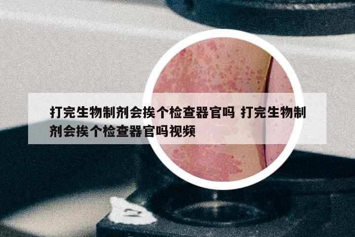 打完生物制剂会挨个检查器官吗 打完生物制剂会挨个检查器官吗视频