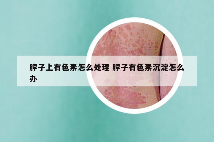 脖子上有色素怎么处理 脖子有色素沉淀怎么办
