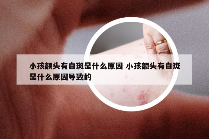 小孩额头有白斑是什么原因 小孩额头有白斑是什么原因导致的