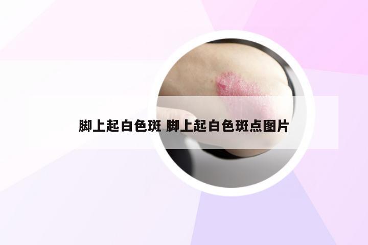 脚上起白色斑 脚上起白色斑点图片