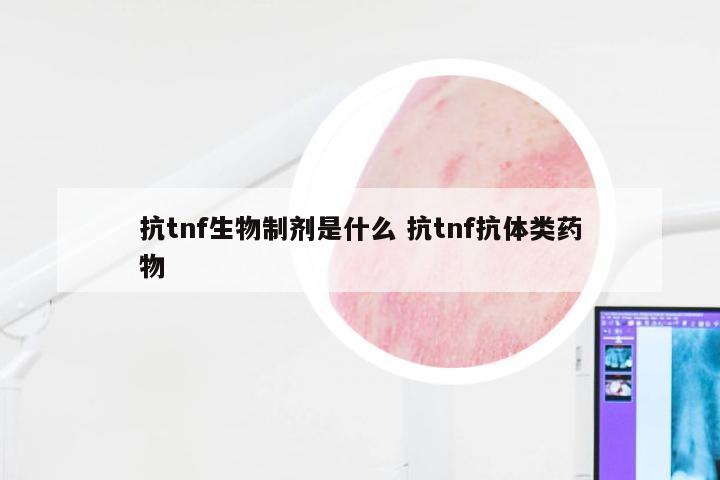 抗tnf生物制剂是什么 抗tnf抗体类药物