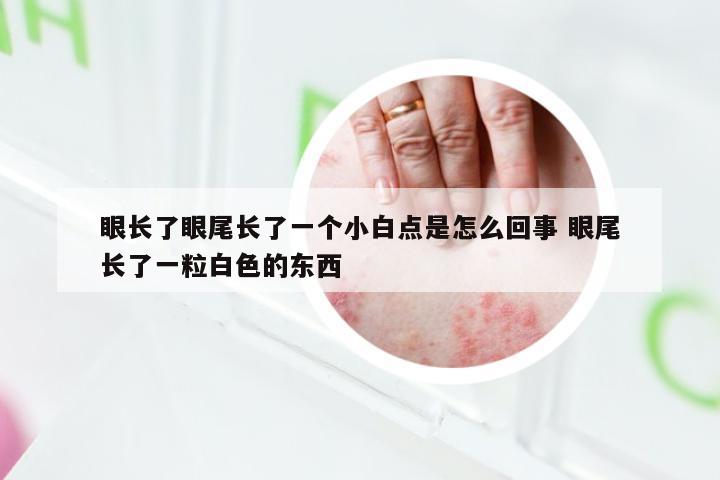 眼长了眼尾长了一个小白点是怎么回事 眼尾长了一粒白色的东西