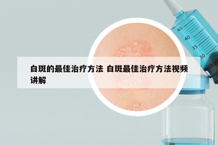 白斑的最佳治疗方法 白斑最佳治疗方法视频讲解