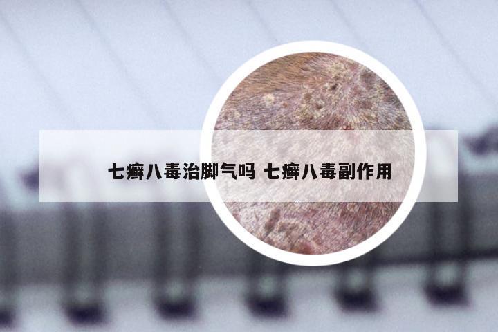 七癣八毒治脚气吗 七癣八毒副作用