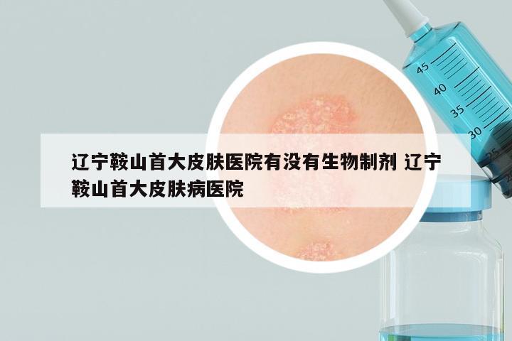 辽宁鞍山首大皮肤医院有没有生物制剂 辽宁鞍山首大皮肤病医院