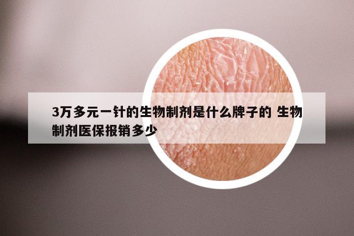 3万多元一针的生物制剂是什么牌子的 生物制剂医保报销多少