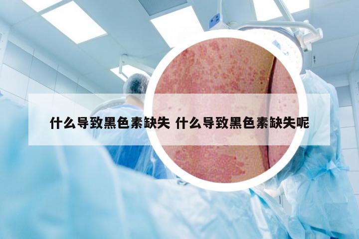 什么导致黑色素缺失 什么导致黑色素缺失呢