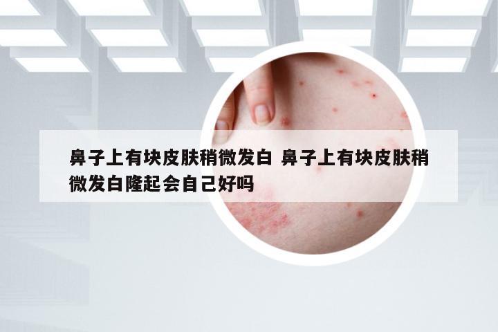 鼻子上有块皮肤稍微发白 鼻子上有块皮肤稍微发白隆起会自己好吗