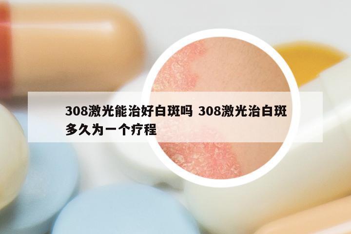 308激光能治好白斑吗 308激光治白斑多久为一个疗程
