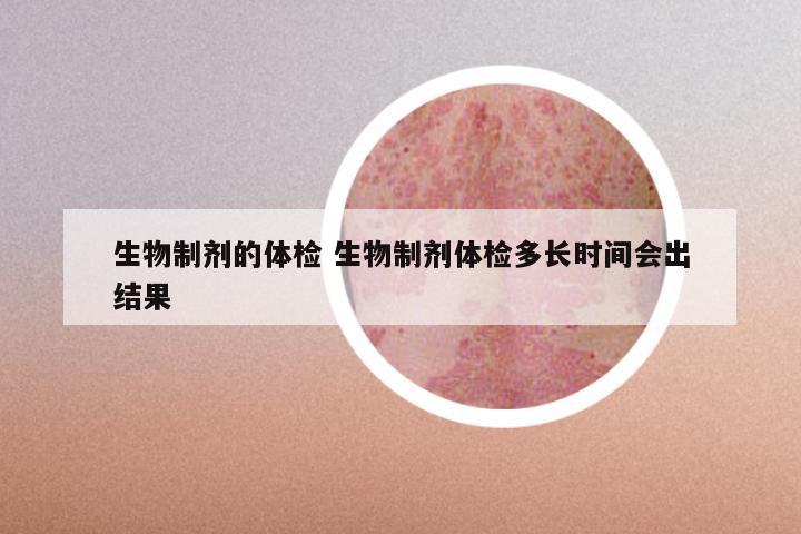 生物制剂的体检 生物制剂体检多长时间会出结果