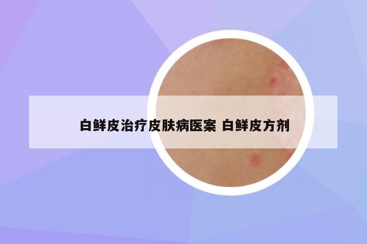 白鲜皮治疗皮肤病医案 白鲜皮方剂