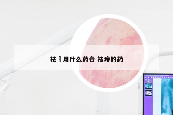祛廯用什么药膏 祛痱的药