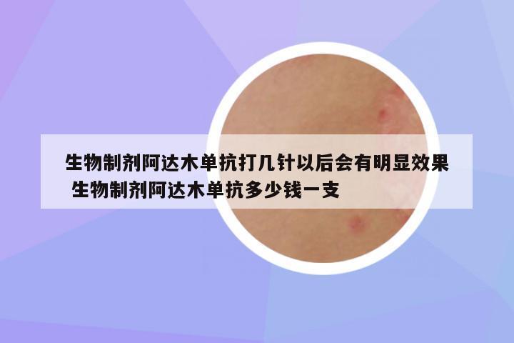 生物制剂阿达木单抗打几针以后会有明显效果 生物制剂阿达木单抗多少钱一支